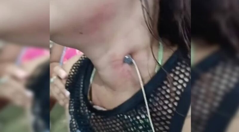 CRIME BRUTAL: Homem crava prego no pescoço da namorada e foge em cidade do Pará!