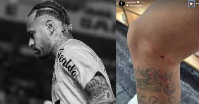 Neymar publica foto da perna machucada e ironiza arbitragem: ‘Podem virar longos 10 meses’